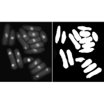 Image Segmentation using Fuzzy MATLAB Code