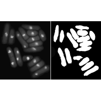 Image Segmentation using Fuzzy MATLAB Code