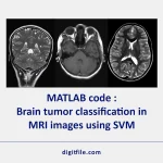 MATLAB code Brain tumor classification in MRI images using SVM [digitfile.com]