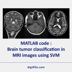 MATLAB code Brain tumor classification in MRI images using SVM [digitfile.com]