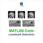 Landmark Detection MATLAB Code